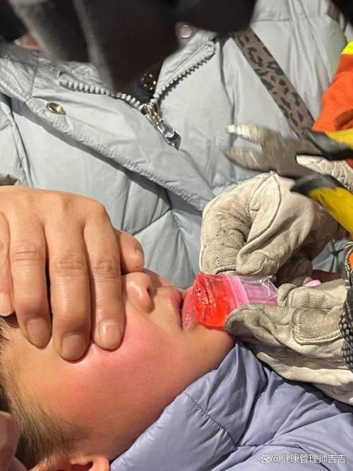 揪心!1岁男童吃糖油粑粑时摔倒,竹筷插入鼻腔……