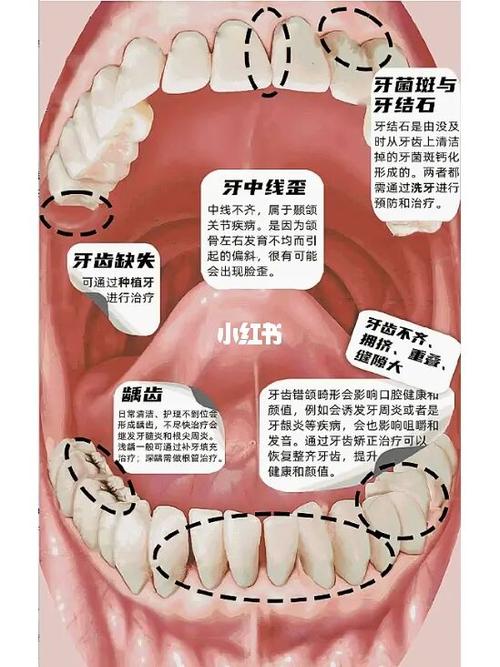 为什么口腔中的“小问题”可能会引起全身性的“大问题”?