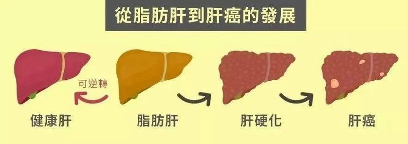 研究发现:45岁前有这个问题的人,多年后更易得癌!