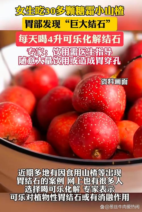 这几种食物不能空腹吃,有人吃出胃结石!